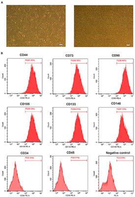 Olfactory Mucosa Mesenchymal Stem Cells Alleviate Cerebral Ischemia/Reperfusion Injury Via Golgi Apparatus Secretory Pathway Ca2+ -ATPase Isoform1